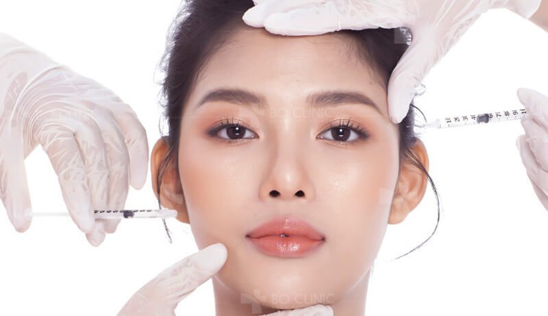 tiêm filler ở hải dương